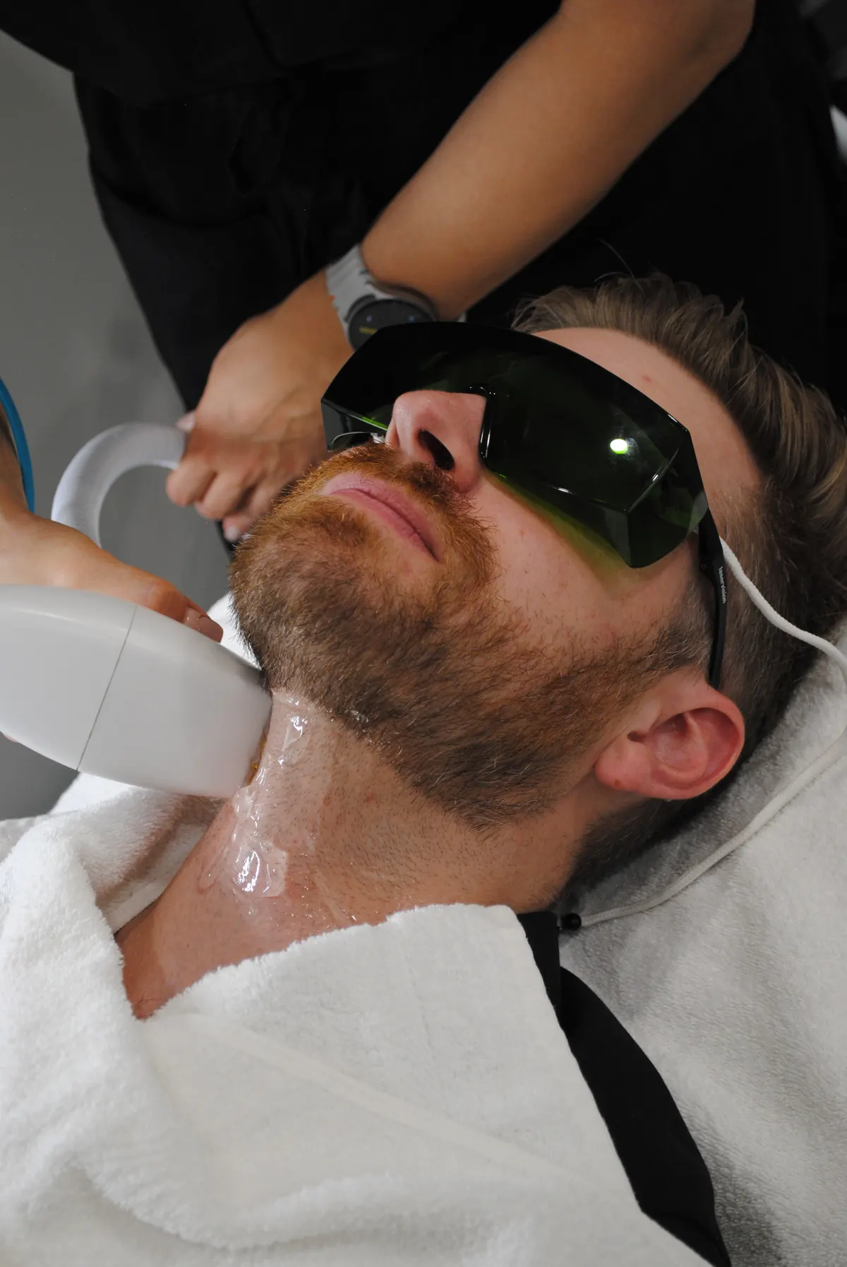 DiolazeXL laser hair removal, with protective eyewear in place